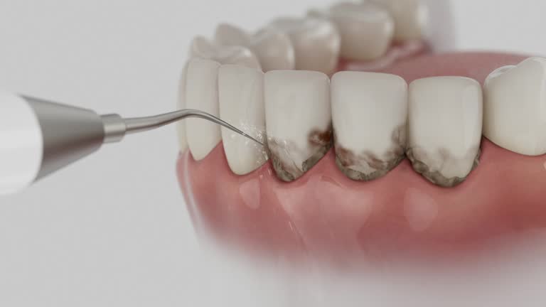 Trusted Tooth Extraction service in Thompson's Station, TN - Dentist Open Now